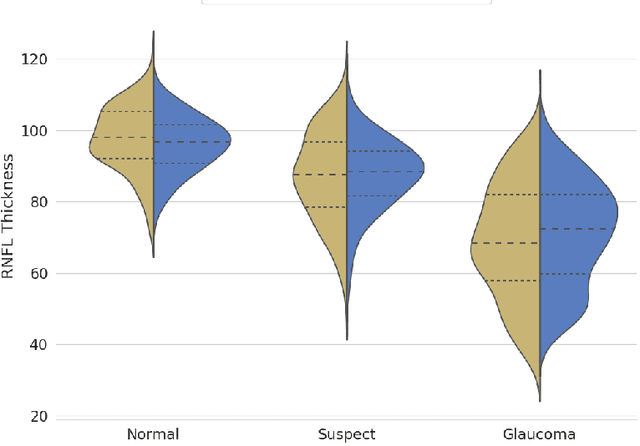 Figure 4 for From Machine to Machine: An OCT-trained Deep Learning Algorithm for Objective Quantification of Glaucomatous Damage in Fundus Photographs