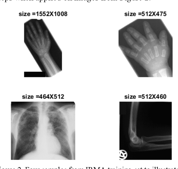 Figure 3 for Retrieving Similar X-Ray Images from Big Image Data Using Radon Barcodes with Single Projections