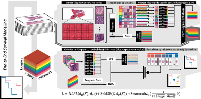 Figure 3 for EPIC-Survival: End-to-end Part Inferred Clustering for Survival Analysis, Featuring Prognostic Stratification Boosting