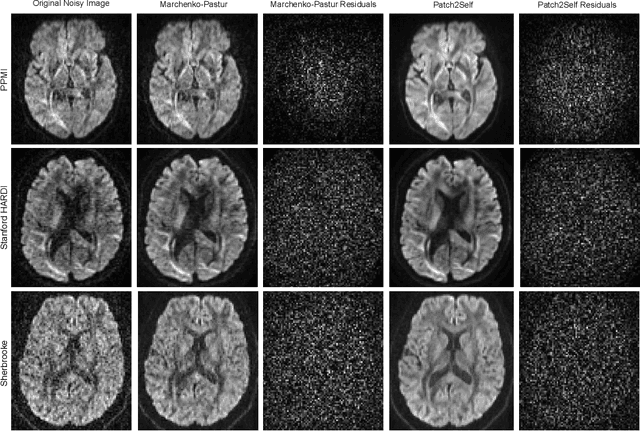Figure 3 for Patch2Self: Denoising Diffusion MRI with Self-Supervised Learning