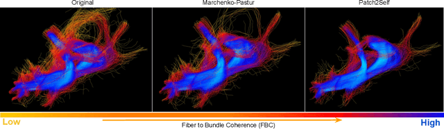 Figure 4 for Patch2Self: Denoising Diffusion MRI with Self-Supervised Learning
