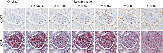 Figure 3 for Self adversarial attack as an augmentation method for immunohistochemical stainings