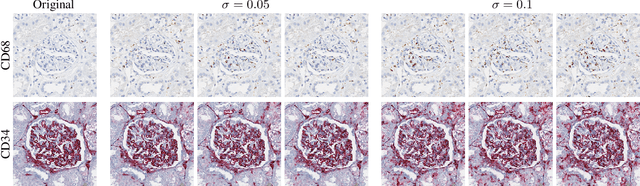 Figure 4 for Self adversarial attack as an augmentation method for immunohistochemical stainings