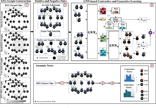 Figure 1 for Self-Supervised Learning for Anomalous Channel Detection in EEG Graphs: Application to Seizure Analysis