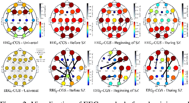 Figure 4 for Self-Supervised Learning for Anomalous Channel Detection in EEG Graphs: Application to Seizure Analysis