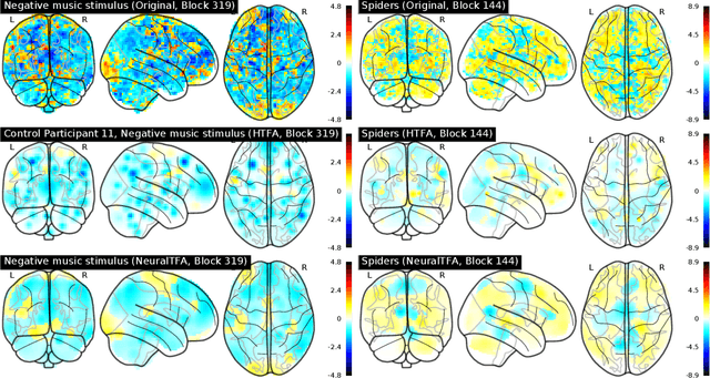 Figure 3 for Neural Topographic Factor Analysis for fMRI Data