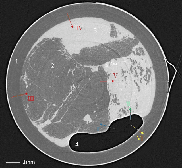 Figure 4 for Tomographic phase and attenuation extraction for a sample composed of unknown materials using X-ray propagation-based phase-contrast imaging