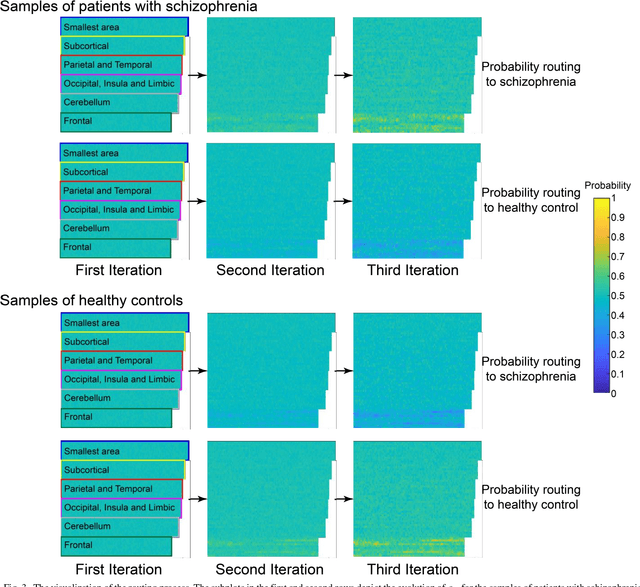 Figure 3 for Multi-Kernel Capsule Network for Schizophrenia Identification