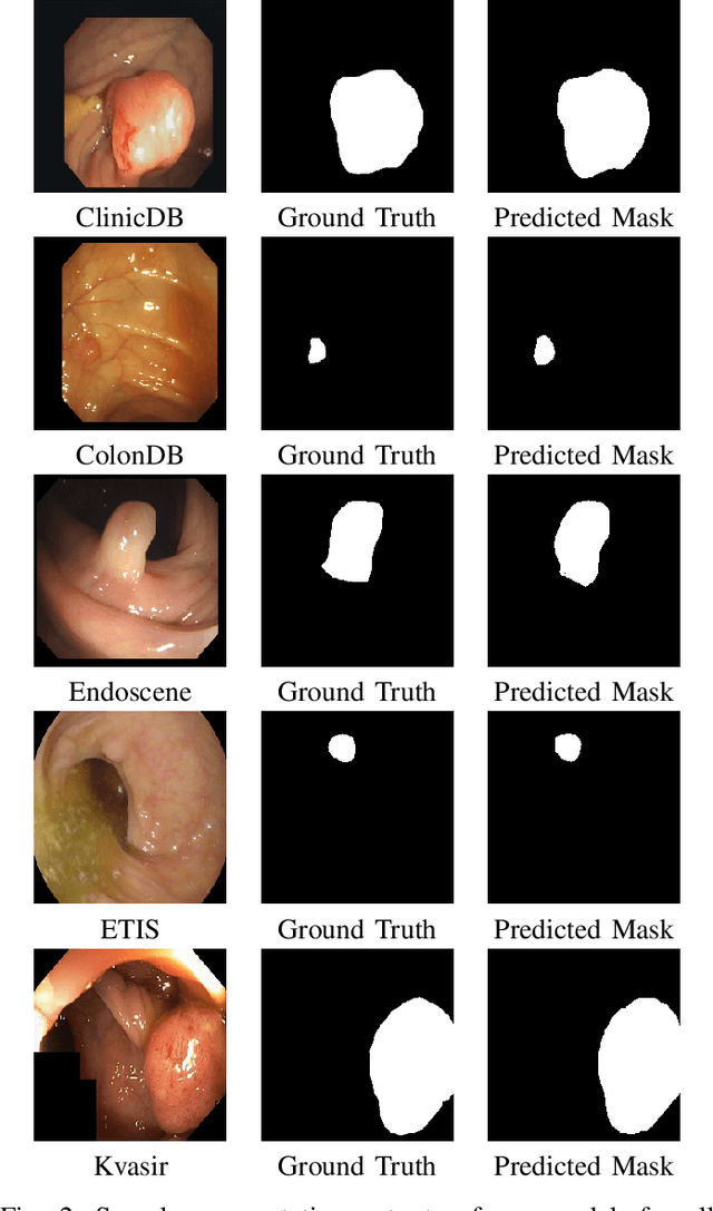 Figure 2 for PlutoNet: An Efficient Polyp Segmentation Network