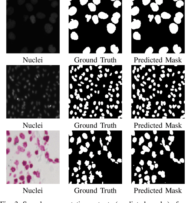 Figure 3 for PlutoNet: An Efficient Polyp Segmentation Network