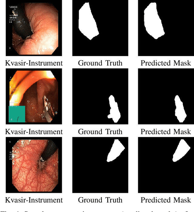 Figure 4 for PlutoNet: An Efficient Polyp Segmentation Network