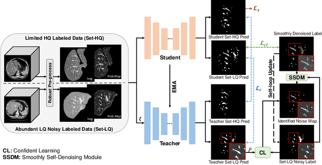 Figure 3 for Noisy Labels are Treasure: Mean-Teacher-Assisted Confident Learning for Hepatic Vessel Segmentation