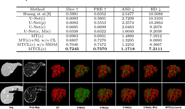 Figure 2 for Noisy Labels are Treasure: Mean-Teacher-Assisted Confident Learning for Hepatic Vessel Segmentation
