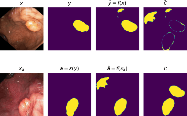 Figure 4 for Segmentation Consistency Training: Out-of-Distribution Generalization for Medical Image Segmentation