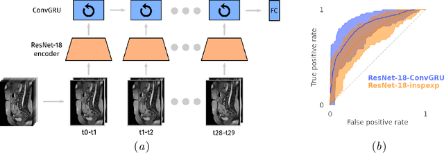 Figure 1 for Cine-MRI detection of abdominal adhesions with spatio-temporal deep learning