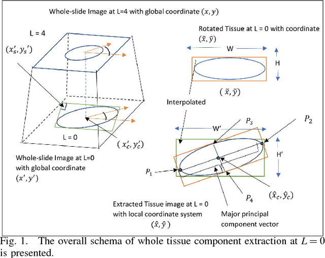 Figure 1 for Segmentation of Overlapped Steatosis in Whole-Slide Liver Histopathology Microscopy Images