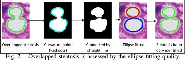 Figure 2 for Segmentation of Overlapped Steatosis in Whole-Slide Liver Histopathology Microscopy Images