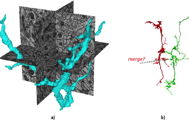 Figure 1 for Large-Scale Electron Microscopy Image Segmentation in Spark