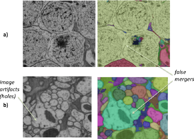 Figure 3 for Large-Scale Electron Microscopy Image Segmentation in Spark