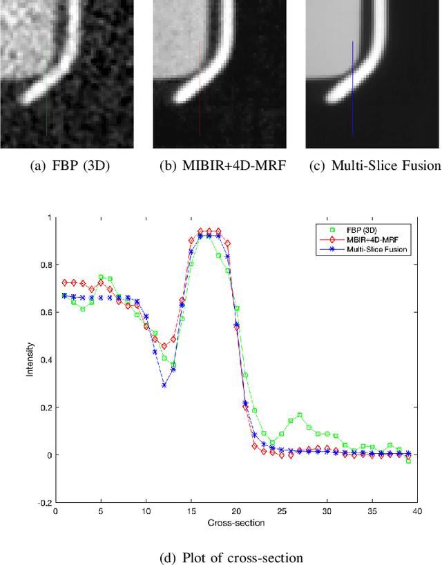 Figure 4 for 4D X-Ray CT Reconstruction using Multi-Slice Fusion