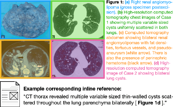 Figure 1 for MedICaT: A Dataset of Medical Images, Captions, and Textual References