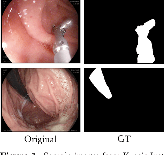 Figure 1 for Performance Comparison of Deep Learning Architectures for Artifact Removal in Gastrointestinal Endoscopic Imaging