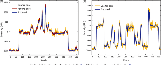 Figure 3 for A deep convolutional neural network using directional wavelets for low-dose X-ray CT reconstruction