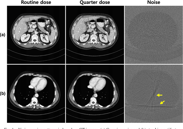 Figure 1 for A deep convolutional neural network using directional wavelets for low-dose X-ray CT reconstruction