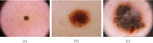 Figure 3 for MultiResUNet : Rethinking the U-Net Architecture for Multimodal Biomedical Image Segmentation