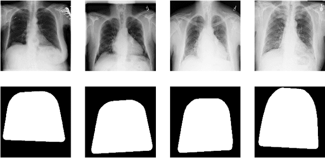 Figure 2 for A Novel Attention Mechanism Using Anatomical Prior Probability Maps for Thoracic Disease Classification from X-Ray Images