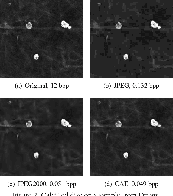 Figure 2 for Fully Convolutional Model for Variable Bit Length and Lossy High Density Compression of Mammograms
