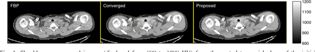 Figure 1 for Fast X-ray CT image reconstruction using the linearized augmented Lagrangian method with ordered subsets