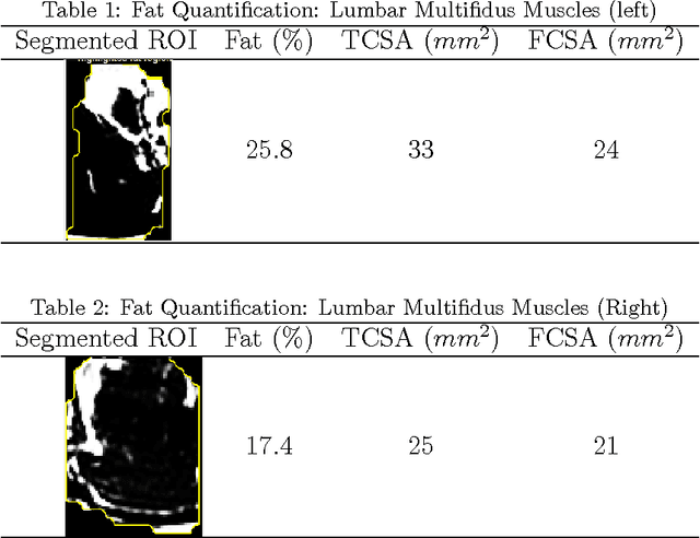 Figure 2 for An Interactive Segmentation Tool for Quantifying Fat in Lumbar Muscles using Axial Lumbar-Spine MRI