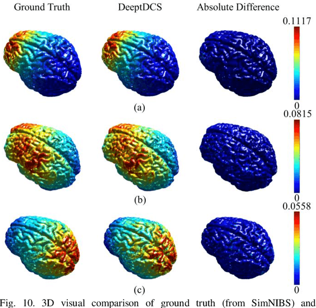 Figure 2 for DeeptDCS: Deep Learning-Based Estimation of Currents Induced During Transcranial Direct Current Stimulation