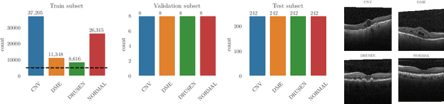 Figure 1 for Matching the Clinical Reality: Accurate OCT-Based Diagnosis From Few Labels