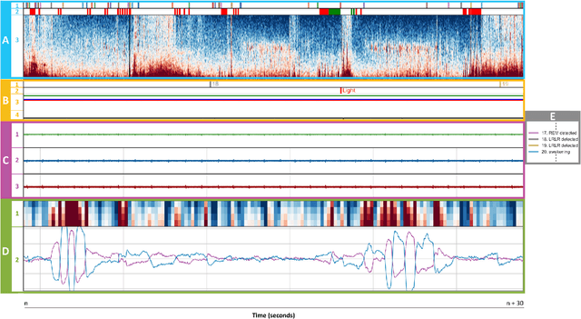 Figure 4 for Dreamento: An open-source dream engineering toolbox utilizing sleep wearable