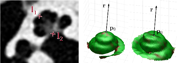 Figure 2 for Robust Cochlear Modiolar Axis Detection in CT