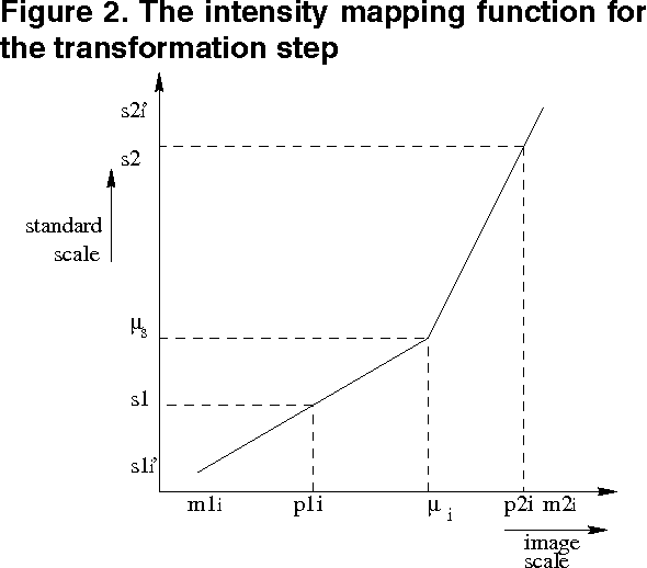 Figure 3 for Multiresolution Elastic Medical Image Registration in Standard Intensity Scale