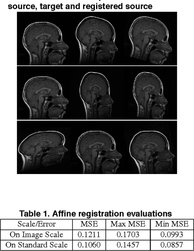 Figure 2 for Multiresolution Elastic Medical Image Registration in Standard Intensity Scale