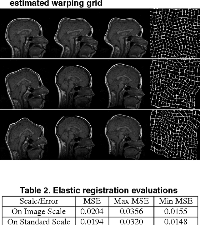 Figure 4 for Multiresolution Elastic Medical Image Registration in Standard Intensity Scale