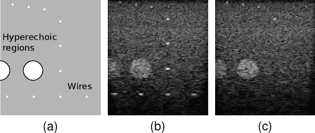 Figure 1 for Redefining Ultrasound Compounding: Computational Sonography