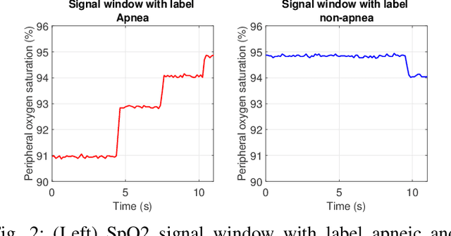 Figure 2 for SomnNET: An SpO2 Based Deep Learning Network for Sleep Apnea Detection in Smartwatches