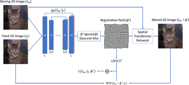 Figure 3 for A Comparative Study for Non-rigid Image Registration and Rigid Image Registration