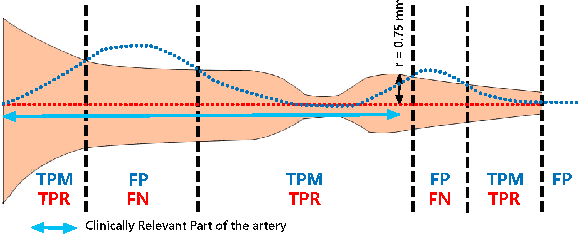 Figure 2 for Multi-Resolution 3D Convolutional Neural Networks for Automatic Coronary Centerline Extraction in Cardiac CT Angiography Scans