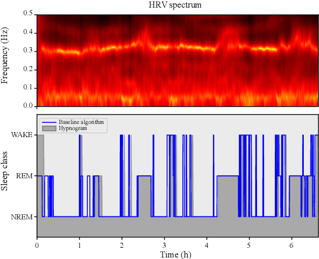 Figure 1 for Embedded Deep Learning for Sleep Staging