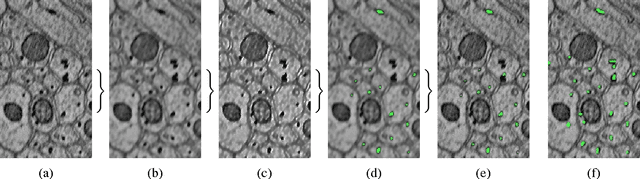 Figure 1 for Automatic Annotation of Axoplasmic Reticula in Pursuit of Connectomes using High-Resolution Neural EM Data