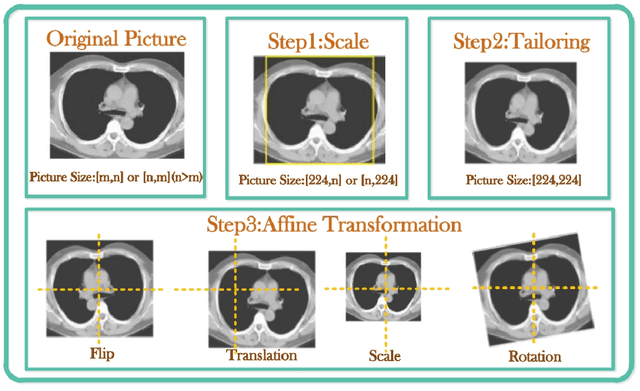 Figure 1 for DPN-SENet:A self-attention mechanism neural network for detection and diagnosis of COVID-19 from chest x-ray images