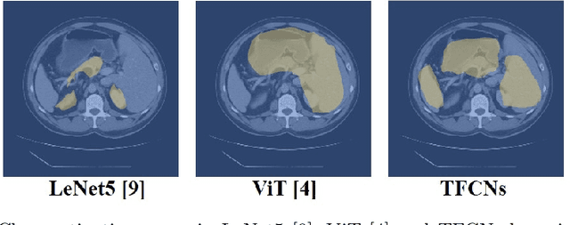 Figure 1 for TFCNs: A CNN-Transformer Hybrid Network for Medical Image Segmentation