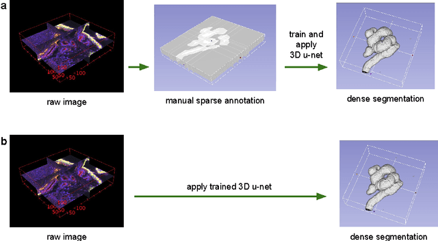 Figure 1 for 3D U-Net: Learning Dense Volumetric Segmentation from Sparse Annotation
