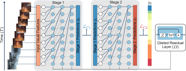 Figure 1 for TeCNO: Surgical Phase Recognition with Multi-Stage Temporal Convolutional Networks